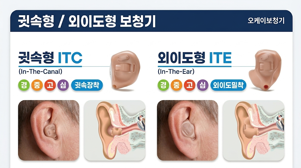 귓속형(ITC) 외이도형(ITE) 보청기 안내 - OK보청기